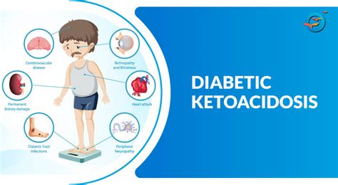 5 Ways To Prevent Diabetic Ketoacidosis Military And Veteran