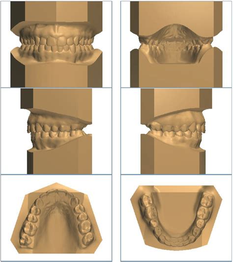 Digital Services Excel Orthodontics